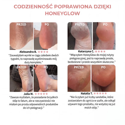 HoneyGlow™ Zestaw do pielęgnacji stóp