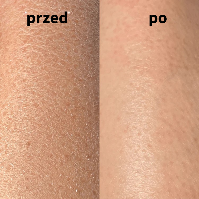 Rękawica peelingująca 2w1 - gładka i promienna skóra !